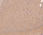 GABA A Receptor beta 3 Antibody in Immunohistochemistry (Paraffin) (IHC (P))