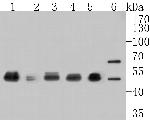 GABA A Receptor beta 3 Antibody in Western Blot (WB)