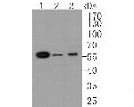 Activin Receptor Type IA Antibody in Western Blot (WB)