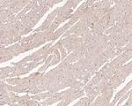 UCP1 Antibody in Immunohistochemistry (Paraffin) (IHC (P))