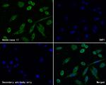 Hexokinase II Antibody in Immunocytochemistry (ICC/IF)