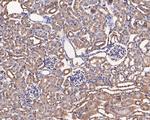 Hexokinase II Antibody in Immunohistochemistry (Paraffin) (IHC (P))