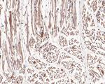 Hexokinase II Antibody in Immunohistochemistry (Paraffin) (IHC (P))