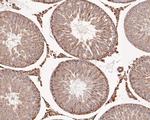 Hexokinase II Antibody in Immunohistochemistry (Paraffin) (IHC (P))