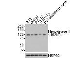 Hexokinase II Antibody in Western Blot (WB)