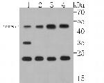 Myelin PLP Antibody in Western Blot (WB)