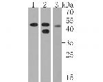 Cannabinoid Receptor I Antibody in Western Blot (WB)