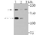 NMDAR2B Antibody in Western Blot (WB)