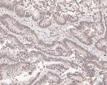 SF3A1 Antibody in Immunohistochemistry (Paraffin) (IHC (P))