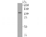 SF3A1 Antibody in Western Blot (WB)