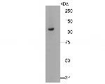 Butyrylcholine esterase Antibody in Western Blot (WB)