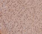 NMBR Antibody in Immunohistochemistry (Paraffin) (IHC (P))