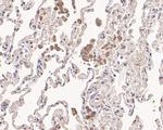 MVD Antibody in Immunohistochemistry (Paraffin) (IHC (P))