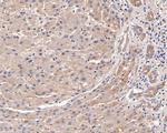 MVD Antibody in Immunohistochemistry (Paraffin) (IHC (P))