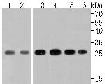 Triosephosphate isomerase Antibody in Western Blot (WB)