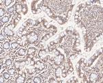 HNF1 alpha Antibody in Immunohistochemistry (Paraffin) (IHC (P))
