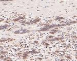 TCP1 delta Antibody in Immunohistochemistry (Paraffin) (IHC (P))