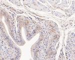 TCP1 delta Antibody in Immunohistochemistry (Paraffin) (IHC (P))