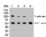 TCP1 delta Antibody in Western Blot (WB)