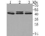 IL-10RB Antibody in Western Blot (WB)