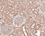 LAMB3 Antibody in Immunohistochemistry (Paraffin) (IHC (P))