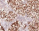 Sall4 Antibody in Immunohistochemistry (Paraffin) (IHC (P))