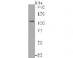 Sall4 Antibody in Western Blot (WB)