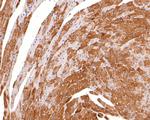 KCNIP2 Antibody in Immunohistochemistry (Paraffin) (IHC (P))