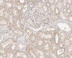 CD151 Antibody in Immunohistochemistry (Paraffin) (IHC (P))