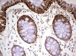 HADH Antibody in Immunohistochemistry (Paraffin) (IHC (P))