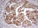 HADH Antibody in Immunohistochemistry (Paraffin) (IHC (P))