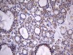 HADH Antibody in Immunohistochemistry (Paraffin) (IHC (P))