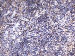 HADH Antibody in Immunohistochemistry (Paraffin) (IHC (P))