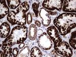 HADH Antibody in Immunohistochemistry (Paraffin) (IHC (P))