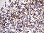 HADH Antibody in Immunohistochemistry (Paraffin) (IHC (P))