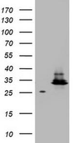 HADH Antibody in Western Blot (WB)