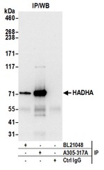 HADHA Antibody in Western Blot (WB)