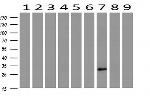 HAND1 Antibody in Western Blot (WB)