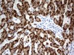 HAO1 Antibody in Immunohistochemistry (Paraffin) (IHC (P))