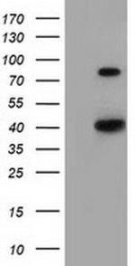 HAO1 Antibody in Western Blot (WB)