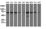 HAO1 Antibody in Western Blot (WB)