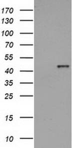 HAO1 Antibody in Western Blot (WB)