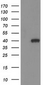 HAO1 Antibody in Western Blot (WB)