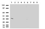 HAO1 Antibody in Western Blot (WB)