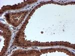 HARS2 Antibody in Immunohistochemistry (Paraffin) (IHC (P))