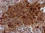 HARS2 Antibody in Immunohistochemistry (Paraffin) (IHC (P))