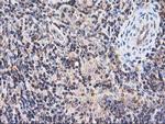 HARS2 Antibody in Immunohistochemistry (Paraffin) (IHC (P))