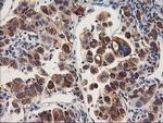 HARS2 Antibody in Immunohistochemistry (Paraffin) (IHC (P))