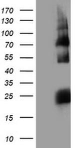 HARS2 Antibody in Western Blot (WB)