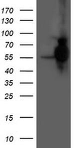 HARS2 Antibody in Western Blot (WB)